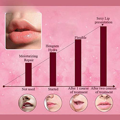 Felico Lip Mask Patches - 30 PCS Collagen Crystal Pink Care Gel Pads for Moisturizing, Anti-Wrinkle, and Hydrating Lips