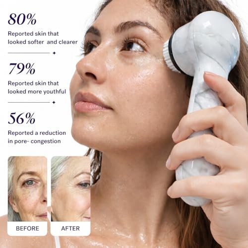 Michael Todd Beauty Soniclear Allure 2024 Best of Beauty Winner Facial Cleansing + Exfoliation Brush System with Antimicrobial Protected Bristles, 4 Speeds, Serum Infusion Head + Travel Case Avelisse