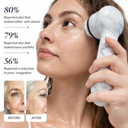 Michael Todd Beauty Soniclear Allure 2024 Best of Beauty Winner Facial Cleansing + Exfoliation Brush System with Antimicrobial Protected Bristles, 4 Speeds, Serum Infusion Head + Travel Case Avelisse