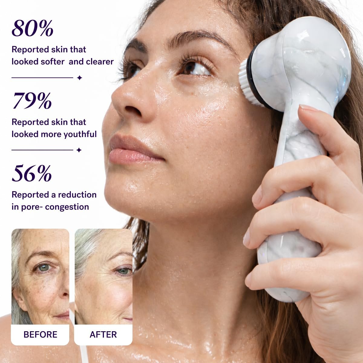 Michael Todd Beauty Soniclear Allure 2024 Best of Beauty Winner Facial Cleansing + Exfoliation Brush System with Antimicrobial Protected Bristles, 4 Speeds, Serum Infusion Head + Travel Case Avelisse
