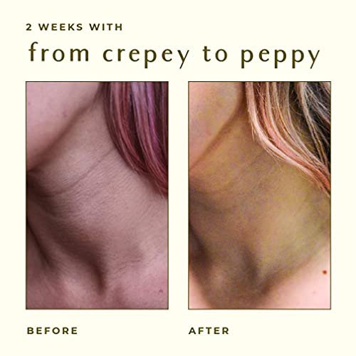 AYADARA Crepey Skin Repair Cream 8oz – Firming Lotion for Loose Skin, Collagen Body Cream for Tightening Arms, Legs, Face & Neck Avelisse