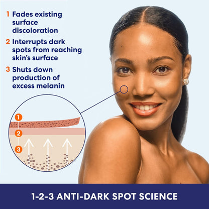 Palmer's Skin Success Anti-Dark Spot Fade Cream for Dry Skin, 4.4 oz