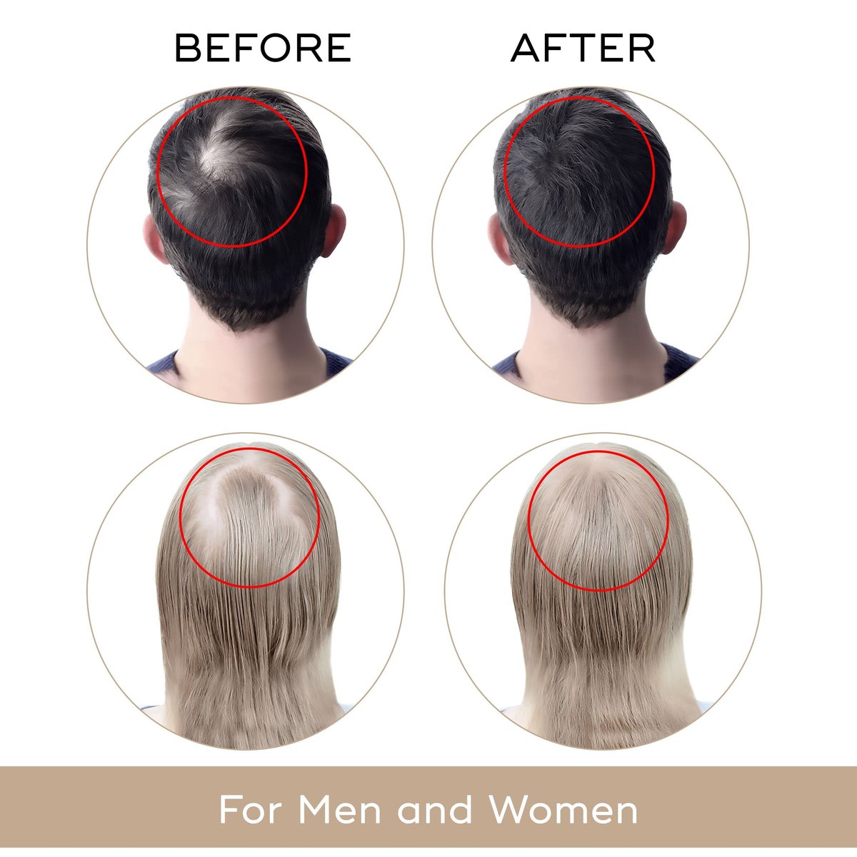 USA Dekohair Hair Regrowth Serum – Stop Thinning, Boost Growth & Root Volume Avelisse