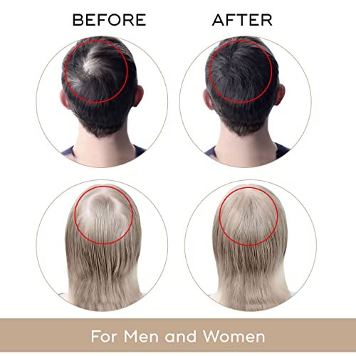 USA Dekohair Hair Regrowth Serum – Stop Thinning, Boost Growth & Root Volume Avelisse