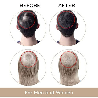 USA Dekohair Hair Regrowth Serum – Stop Thinning, Boost Growth & Root Volume Avelisse