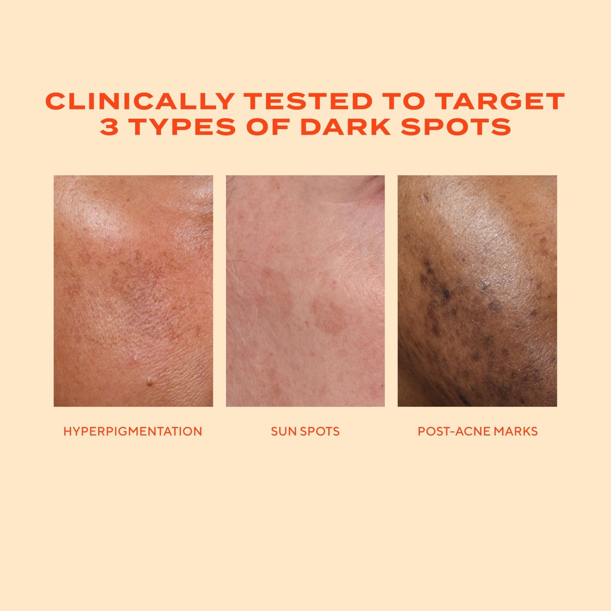 Murad Rapid Dark Spot Correcting Serum – Advanced Anti-Aging Formula with Patented Resorcinol Technology, Tranexamic and Glycolic Acids for Hyperpigmentation, Dark Spots and Dull Skin – 1 Fl Oz Avelisse