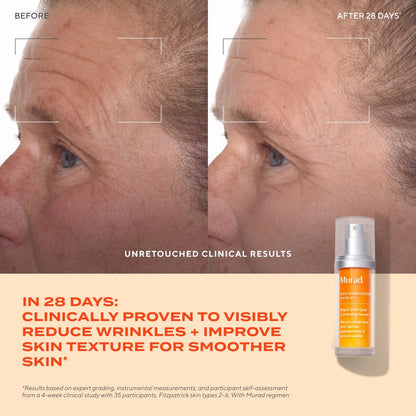 Murad Rapid Dark Spot Correcting Serum – Advanced Anti-Aging Formula with Patented Resorcinol Technology, Tranexamic and Glycolic Acids for Hyperpigmentation, Dark Spots and Dull Skin – 1 Fl Oz Avelisse
