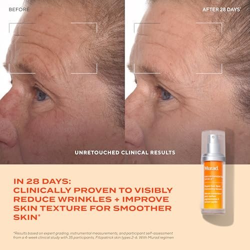 Murad Rapid Dark Spot Correcting Serum – Advanced Anti-Aging Formula with Patented Resorcinol Technology, Tranexamic and Glycolic Acids for Hyperpigmentation, Dark Spots and Dull Skin – 1 Fl Oz Avelisse