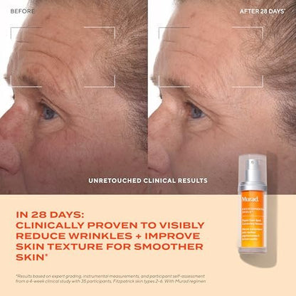 Murad Rapid Dark Spot Correcting Serum – Advanced Anti-Aging Formula with Patented Resorcinol Technology, Tranexamic and Glycolic Acids for Hyperpigmentation, Dark Spots and Dull Skin – 1 Fl Oz Avelisse