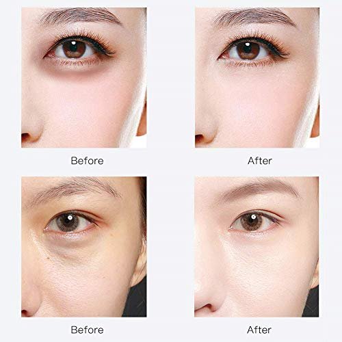 RABIOTA Under Eye Patches – 30 Pairs Hyaluronic Acid & Collagen Anti-Aging Eye Mask for Dark Circles, Wrinkles, Puffiness (Blue) - görsel 10