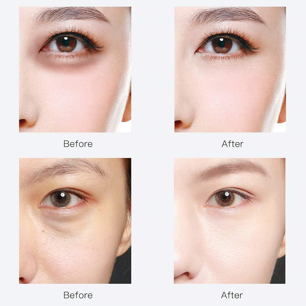 RABIOTA Under Eye Patches – 30 Pairs Hyaluronic Acid & Collagen Anti-Aging Eye Mask for Dark Circles, Wrinkles, Puffiness (Blue) - görsel 9
