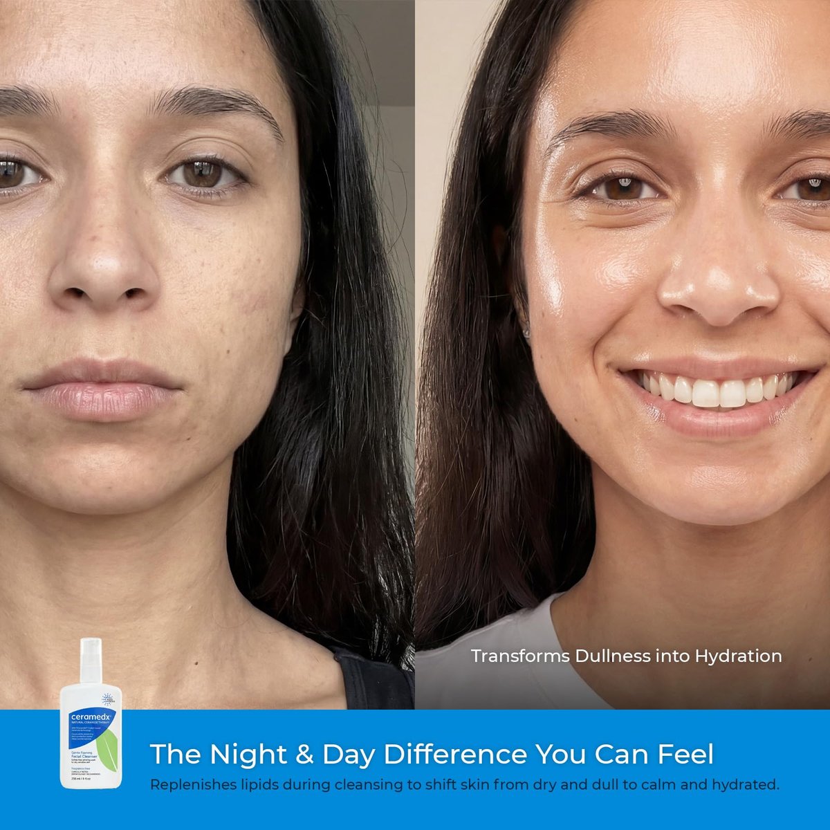 Ceramedx Gentle Foaming Facial Cleanser with Natural Ceramides for Dry, Sensitive Skin, Cruelty Free, Vegan & Fragrance Free, 8 fl oz Avelisse
