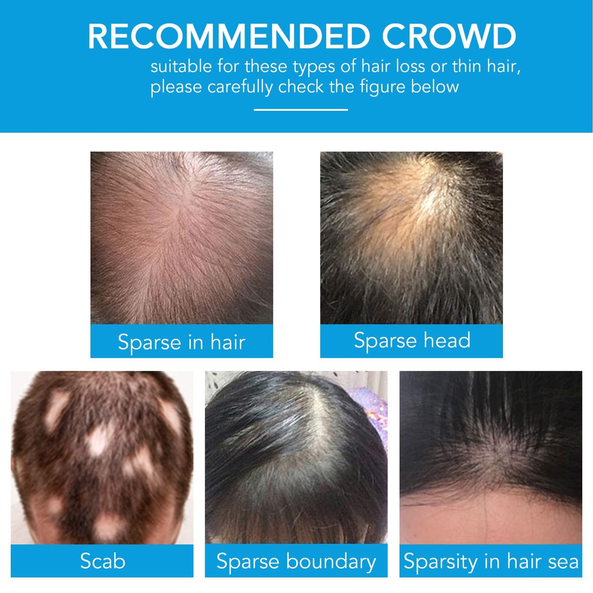 Dark Brown Hair Building Fibers - Instant Hair Thickening Fibers for Thinning Hair & Bald Spots, 0.97 oz - görsel 16