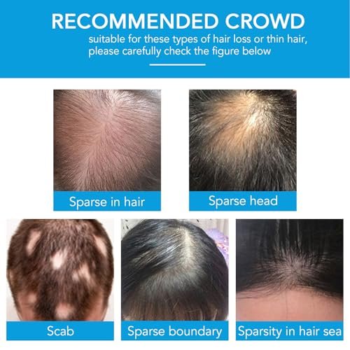 Dark Brown Hair Building Fibers - Instant Hair Thickening Fibers for Thinning Hair & Bald Spots, 0.97 oz - görsel 15