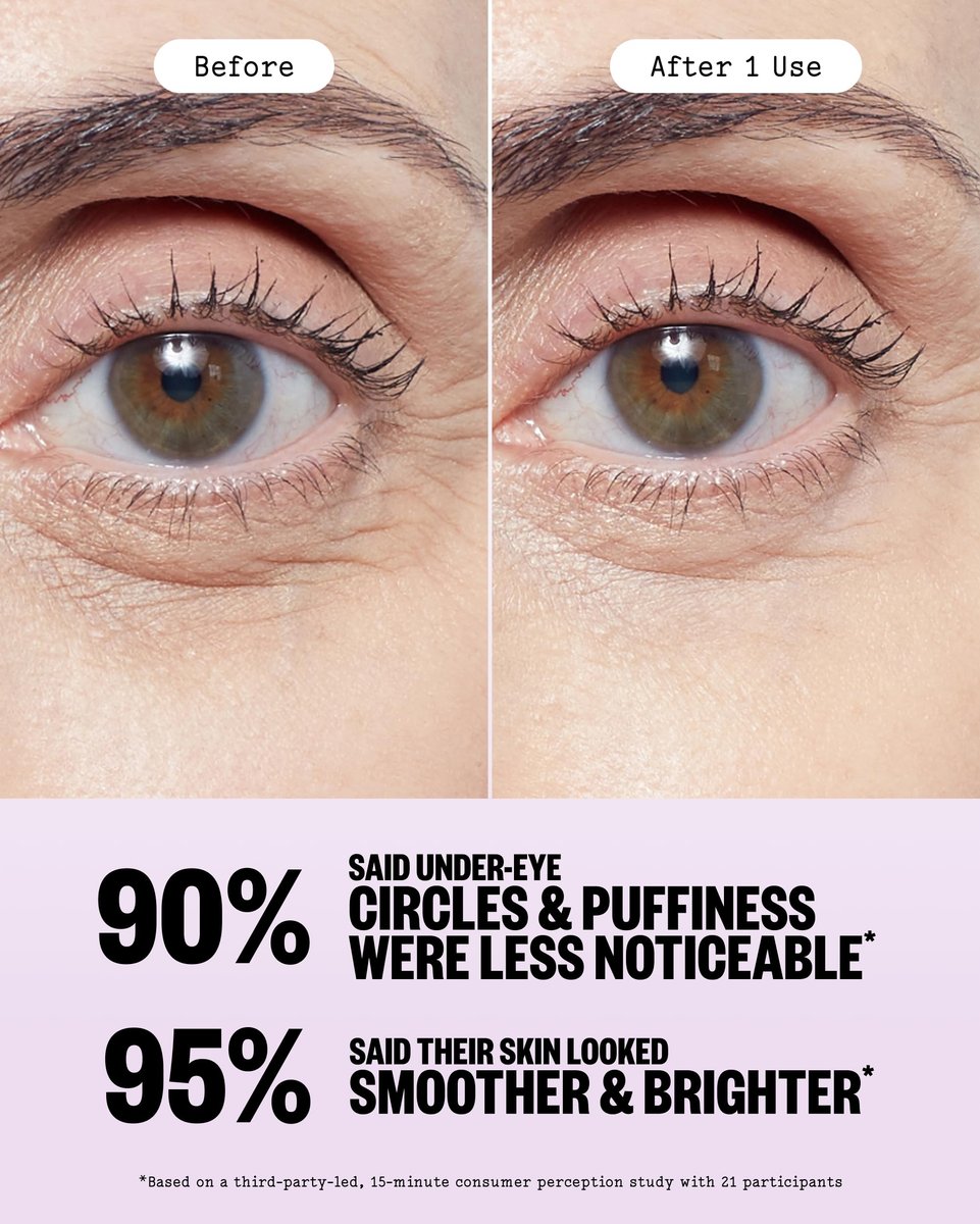 PEACE OUT Puffy Eyes Under Eye Patches - Biocellulose Mask with Caffeine, Niacinamide, Hyaluronic Acid - 6 Pairs Avelisse
