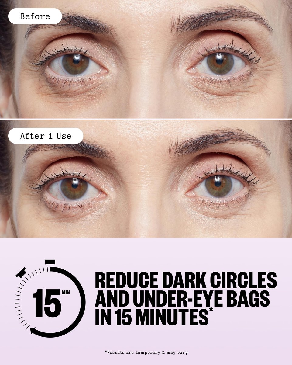 PEACE OUT Puffy Eyes Under Eye Patches - Biocellulose Mask with Caffeine, Niacinamide, Hyaluronic Acid - 6 Pairs Avelisse