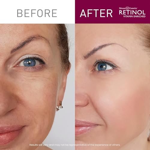Retinol LIVAURA Cream Face Wash – Hydrating Facial Cleanser for Women, Gentle Face Wash for Sensitive, Dry, Oily & Acne Prone Skin, 5 Fl Oz Avelisse