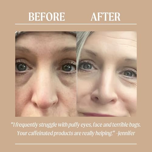 UpCircle Eye Cream with Coffee & Hyaluronic Acid – Natural, Vegan & Cruelty-Free for Dark Circles, Puffiness & Wrinkles (0.5 fl oz) Avelisse