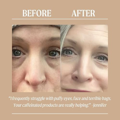 UpCircle Eye Cream with Coffee & Hyaluronic Acid – Natural, Vegan & Cruelty-Free for Dark Circles, Puffiness & Wrinkles (0.5 fl oz) Avelisse