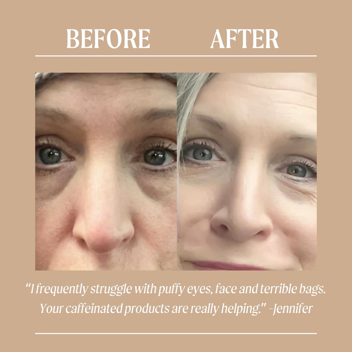 UpCircle Eye Cream with Coffee & Hyaluronic Acid – Natural, Vegan & Cruelty-Free for Dark Circles, Puffiness & Wrinkles (0.5 fl oz) Avelisse