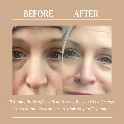 UpCircle Eye Cream with Coffee & Hyaluronic Acid – Natural, Vegan & Cruelty-Free for Dark Circles, Puffiness & Wrinkles (0.5 fl oz) Avelisse