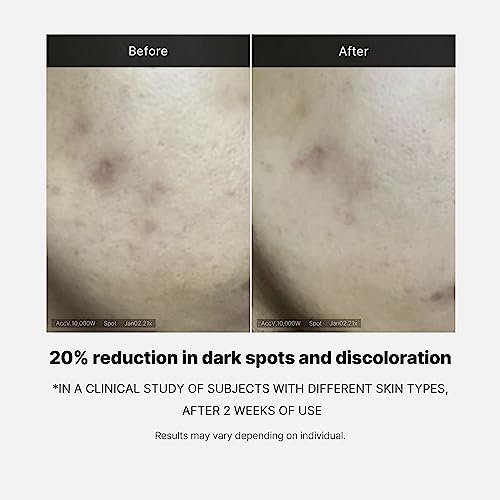 Medicube Deep Vita C Serum 2.0 - 14.5% Pure Vitamin C Serum for Hyperpigmentation, Dark Spots & Blemishes | Korean Skincare | 3 x 10g Bottles with 16 Self-Tests - görsel 7