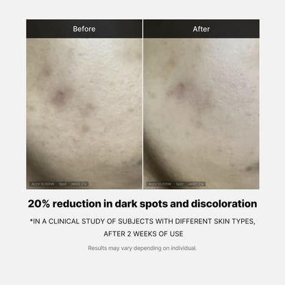 Medicube Deep Vita C Serum 2.0 - 14.5% Pure Vitamin C Serum for Hyperpigmentation, Dark Spots & Blemishes | Korean Skincare | 3 x 10g Bottles with 16 Self-Tests