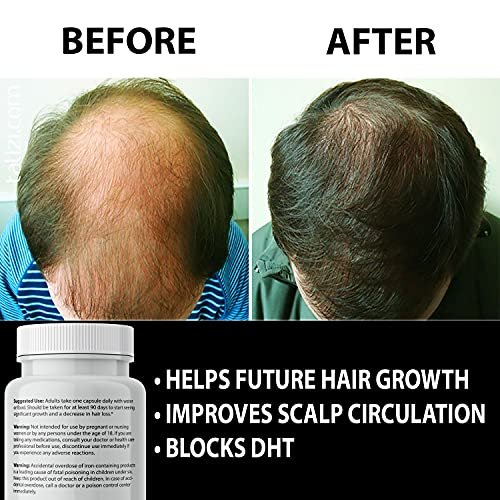 Finanutride Natural DHT Blocker & Hair Growth Capsules – Prevent Hair Loss, Stimulate Follicles, Proprietary Regrowth Treatment Avelisse