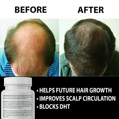 Finanutride Natural DHT Blocker & Hair Growth Capsules – Prevent Hair Loss, Stimulate Follicles, Proprietary Regrowth Treatment Avelisse
