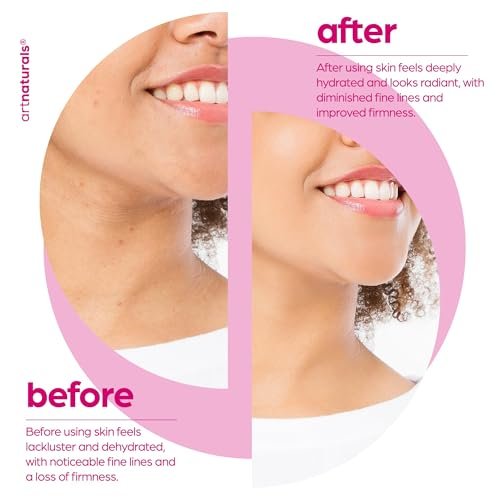 Artnaturals Collagen Booster Serum for Face - Anti-Aging with Hyaluronic Acid & Vitamin E - Reduces Wrinkles, Improves Tone & Texture - 1 oz Avelisse