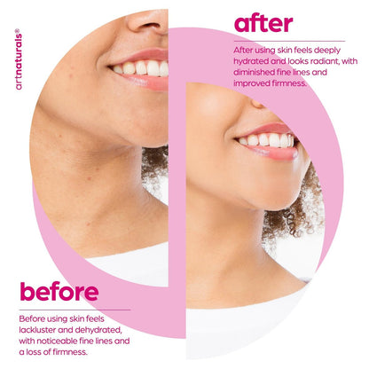 Artnaturals Collagen Booster Serum for Face - Anti-Aging with Hyaluronic Acid & Vitamin E - Reduces Wrinkles, Improves Tone & Texture - 1 oz Avelisse