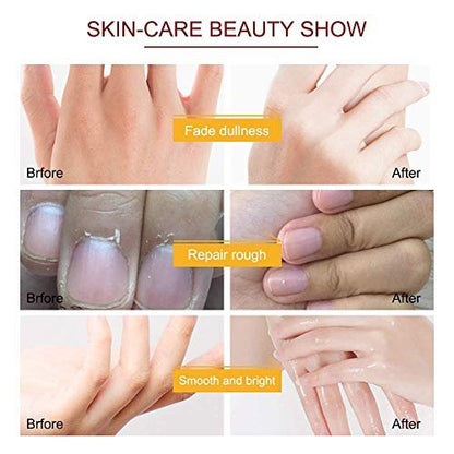 ZIXAOK 5 Pairs Hand Mask Gloves – Moisturizing & Repairing Treatment for Extra Dry & Rough Skin, Exfoliating Peeling Mask for Home Spa Care, Men & Women