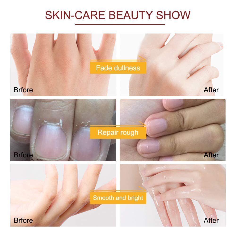 ZIXAOK 5 Pairs Hand Mask Gloves – Moisturizing & Repairing Treatment for Extra Dry & Rough Skin, Exfoliating Peeling Mask for Home Spa Care, Men & Women - görsel 5
