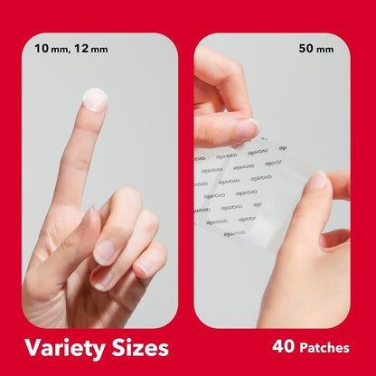 AVARELLE Acne Pimple Patch (40 Count) - Hydrocolloid Spot Treatment with Tea Tree Oil, Calendula Oil & Cica, Vegan & Cruelty-Free