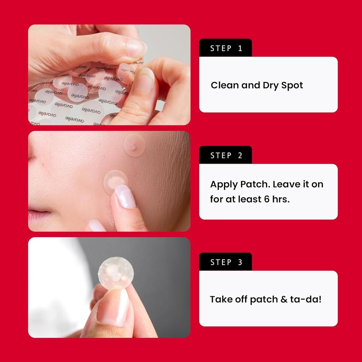 AVARELLE Acne Pimple Patch (40 Count) - Hydrocolloid Spot Treatment with Tea Tree Oil, Calendula Oil & Cica, Vegan & Cruelty-Free - görsel 9