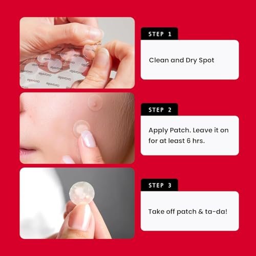 AVARELLE Acne Pimple Patch (40 Count) - Hydrocolloid Spot Treatment with Tea Tree Oil, Calendula Oil & Cica, Vegan & Cruelty-Free - görsel 10