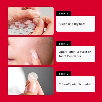AVARELLE Acne Pimple Patch (40 Count) - Hydrocolloid Spot Treatment with Tea Tree Oil, Calendula Oil & Cica, Vegan & Cruelty-Free