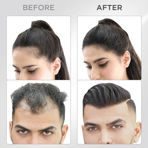 THICK FIBER Hair Fibers for Thinning Hair & Bald Spots (Black, Pack of 2) - 25g Bottle - Conceals Hair Loss in Seconds - Hair Powder for Women & Men Avelisse