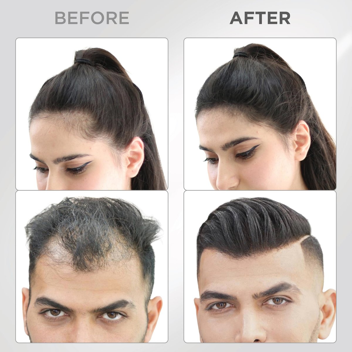 THICK FIBER Hair Fibers for Thinning Hair & Bald Spots (Black, Pack of 2) - 25g Bottle - Conceals Hair Loss in Seconds - Hair Powder for Women & Men Avelisse