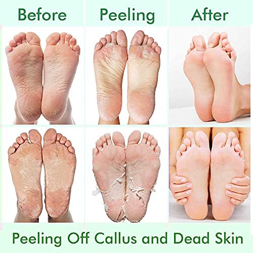 5 Pack Foot Peeling Mask - Exfoliator Peel Off Calluses, Dead Skin Remover for Dry Cracked Feet - Foot Peel Masks for Men and Women - Fathers Mothers Day Gifts - görsel 8