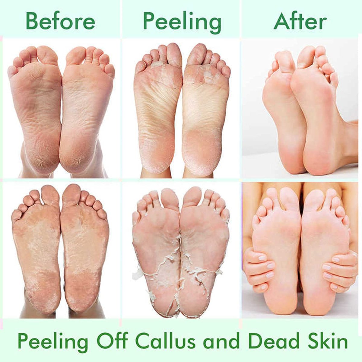 5 Pack Foot Peeling Mask - Exfoliator Peel Off Calluses, Dead Skin Remover for Dry Cracked Feet - Foot Peel Masks for Men and Women - Fathers Mothers Day Gifts - görsel 7