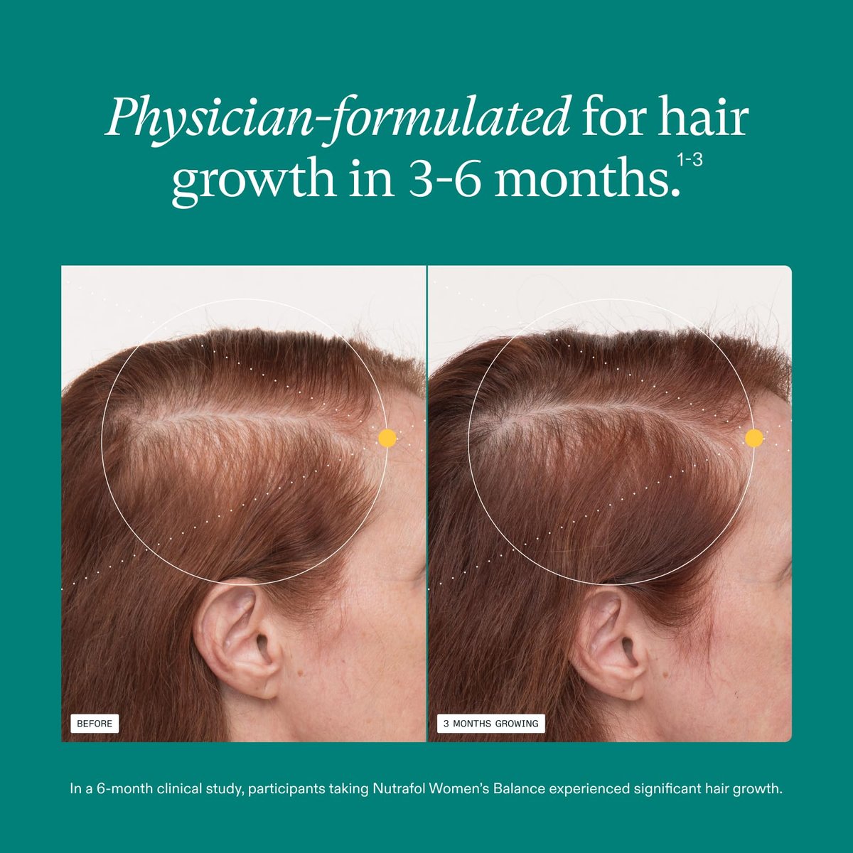 Nutrafol Women's Balance Hair Growth Supplements for Ages 45+ - Dermatologist Recommended, Clinically Proven for Thicker Hair & Scalp Coverage - 2 Month Supply (Pack of 2) Avelisse