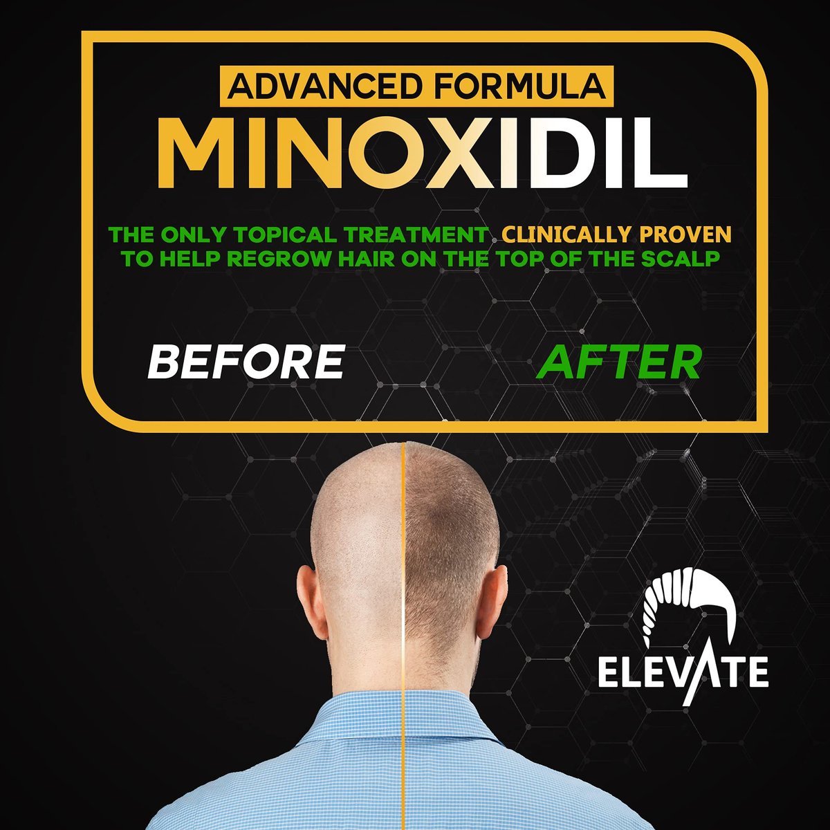 ELEVATE 5% Minoxidil Hair Growth Spray - Alcohol Free, Non-Oily, Extra Strength for Men & Women - 1 Month Supply Avelisse