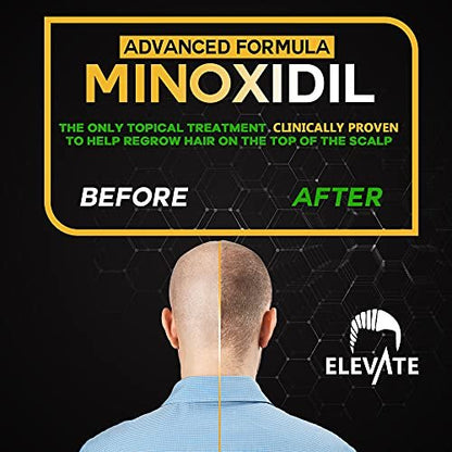 ELEVATE 5% Minoxidil Hair Growth Spray - Alcohol Free, Non-Oily, Extra Strength for Men & Women - 1 Month Supply Avelisse