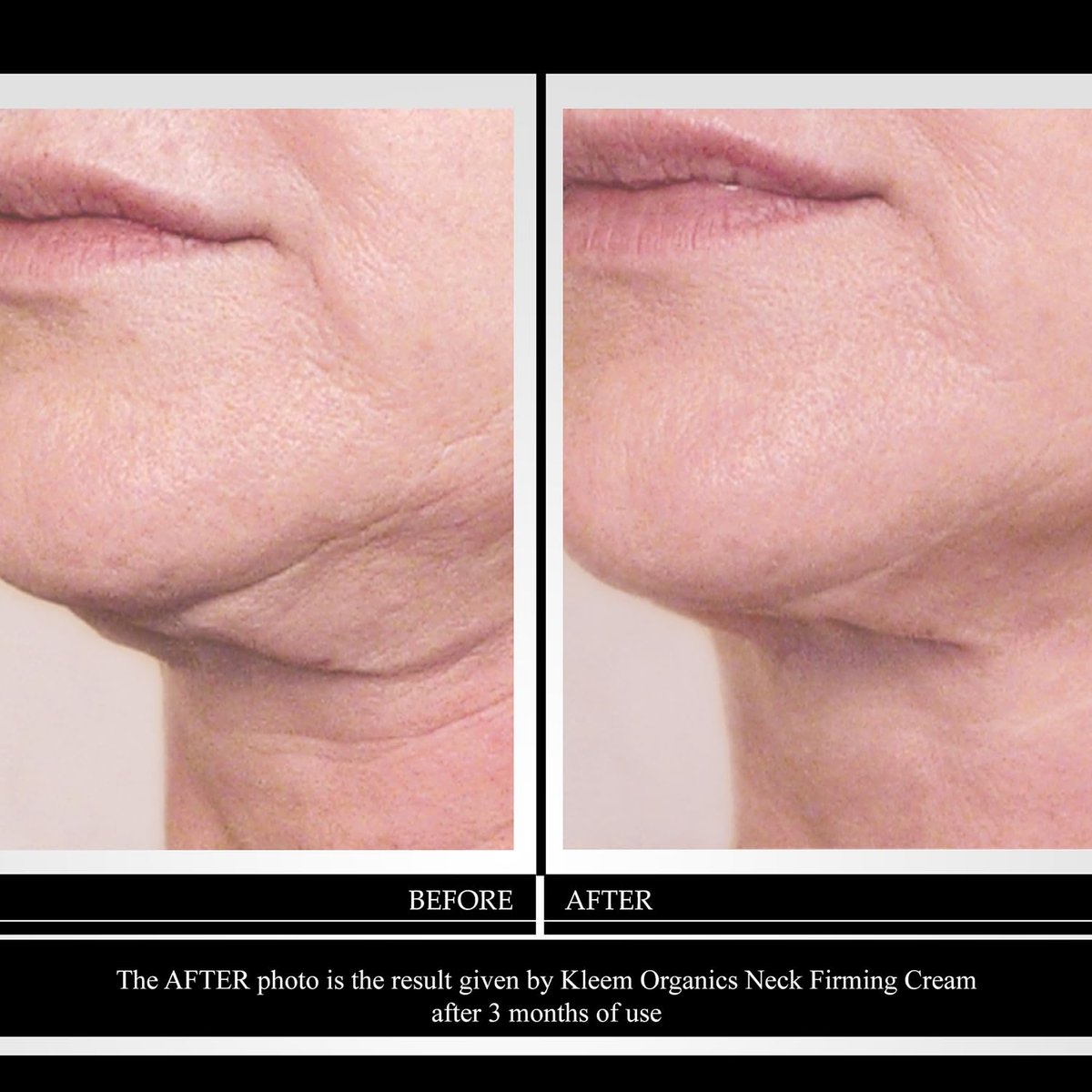Kleem Neck Firming Cream for Sagging Skin - Anti-Aging Neck Cream with Retinol & Panthenol - Hydrating Firming Neck & Décolleté Cream - 1.7 oz Avelisse