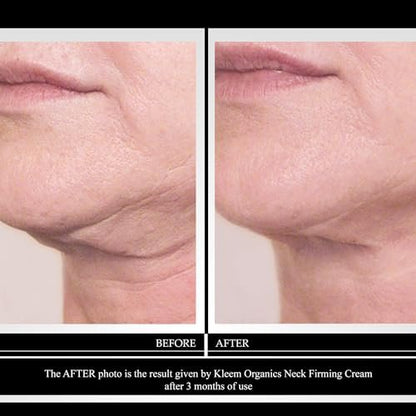 Kleem Neck Firming Cream for Sagging Skin - Anti-Aging Neck Cream with Retinol & Panthenol - Hydrating Firming Neck & Décolleté Cream - 1.7 oz Avelisse