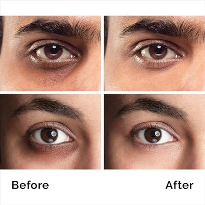 Caffeine Eye Cream for Anti-Aging, Dark Circles, Bags, Puffiness – Under Eye Skin & Face Tightening Treatment for Men & Women 1.7 oz Avelisse