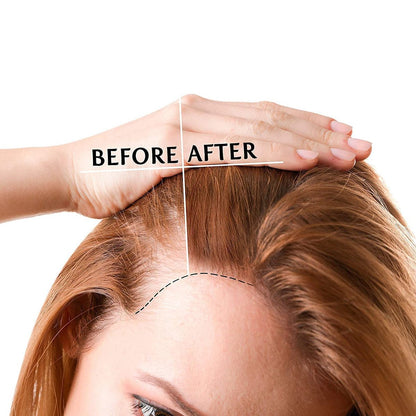 Luv Me Care Biotin Hair Growth Oil – Natural Serum for Thicker, Longer, Fuller Hair | Prevents Hair Loss & Thinning | Vitamin-Rich Treatment for Women & Men, All Hair Types (1.7 oz) Avelisse