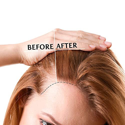 Luv Me Care Biotin Hair Growth Oil – Natural Serum for Thicker, Longer, Fuller Hair | Prevents Hair Loss & Thinning | Vitamin-Rich Treatment for Women & Men, All Hair Types (1.7 oz) Avelisse