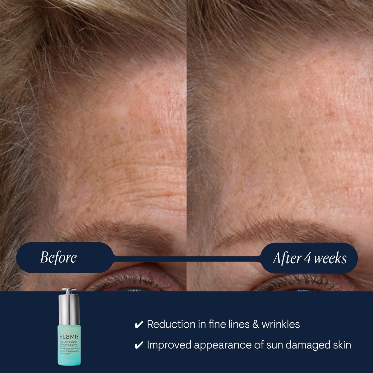 ELEMIS Pro-Collagen Renewal Serum 15ml - Gentle Retinol Alternative for Smoothing Fine Lines & Wrinkles Avelisse